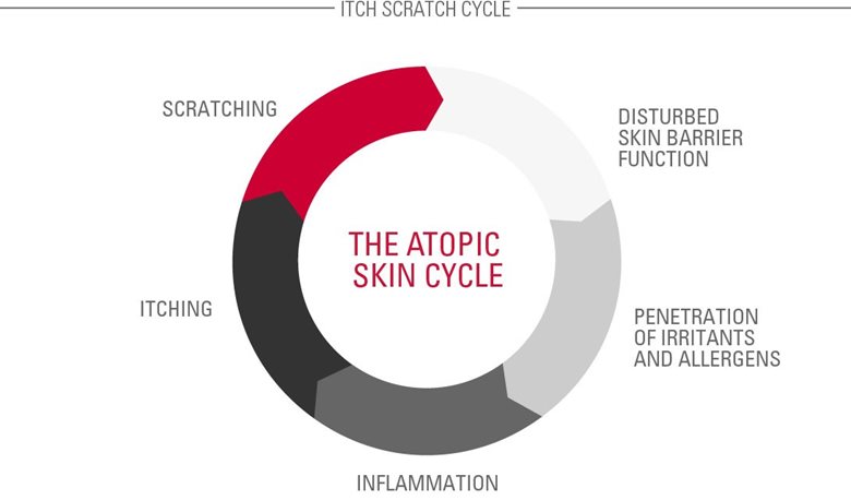 The Atopic Skin Cycle (also known as the Itch-Scratch Cycle)