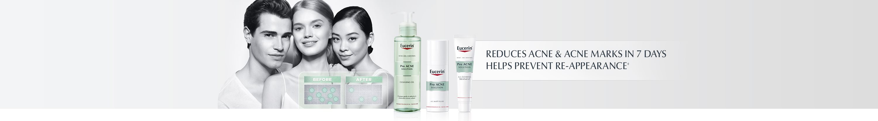 Acne products